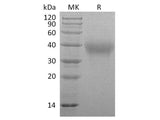Recombinant Marmoset TIM-3/HAVCR2 Protein (His Tag)