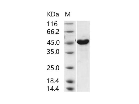 Recombinant MERS-CoV Spike Protein (S1+S2 ECD, aa 1-1297, His Tag)