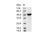 Recombinant MERS-CoV Spike Protein (S1+S2 ECD, aa 1-1297, His Tag)