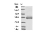 Recombinant MERS-CoV Spike/RBD Protein fragment (RBD, aa 367-606, His Tag), Biotinylated