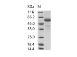 Recombinant MERS-CoV Spike/RBD Protein fragment (RBD, aa 367-606, rFc Tag)