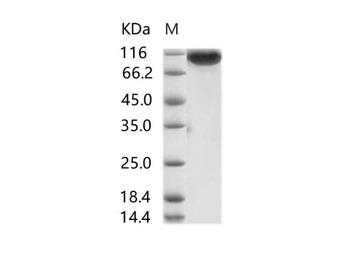 Recombinant MERS-CoV Spike/S1 Protein (S1 Subunit, aa 1-725, His Tag)