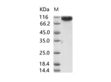 Recombinant MERS-CoV Spike/S1 Protein (S1 Subunit, aa 1-725, His Tag)