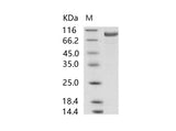 Recombinant MERS-CoV Spike/S1 Protein (S1 Subunit, aa 1-725, His Tag)