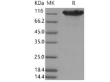Recombinant Mouse ACE2 Protein (His & Fc Tag)