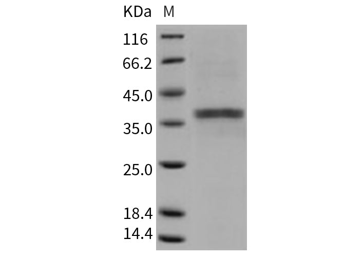 Recombinant Mouse ACP5/TRAP Protein (His Tag)(Active)