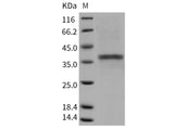 Recombinant Mouse ACP5/TRAP Protein (His Tag)(Active)