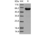 Recombinant Mouse Activin Receptor 2B/ACVR2B Protein (His & Fc Tag)(Active)
