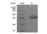 Recombinant Mouse Adiponectin/AdipoQ Protein (Human Cells, His Tag)