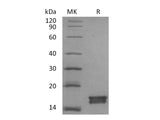 Recombinant Mouse AGR3 Protein (His Tag)