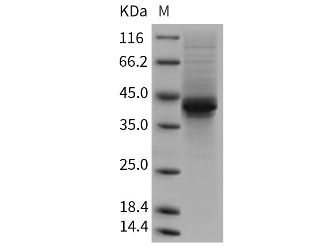 Recombinant Mouse AgRP/AGRP Protein (Fc Tag)