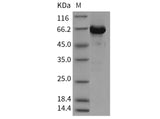 Recombinant Mouse AKT3 Protein (aa 106-479, His & GST Tag)