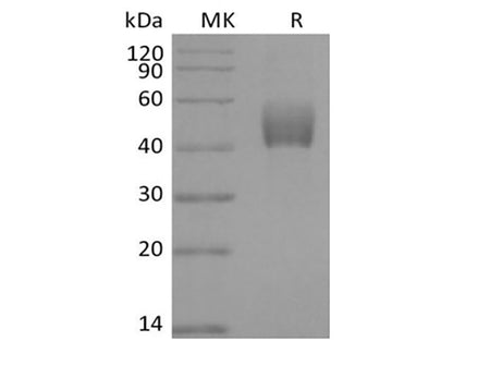 Recombinant Mouse ALK-5/TGFBR1 (C-Fc) - MSE Supplies LLC