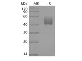 Recombinant Mouse ALK-5/TGFBR1 (C-Fc) - MSE Supplies LLC