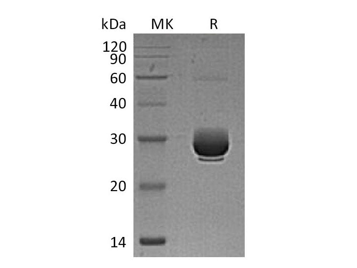 Recombinant Mouse ANGPTL3 Protein (His Tag)