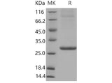Recombinant Mouse APCS/SAP Protein (His Tag)(Active)