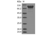Recombinant Mouse APLP1/Amyloid-like Protein (His Tag)