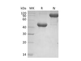 Recombinant Mouse APRIL/TNFSF13 Protein (Fc Tag)