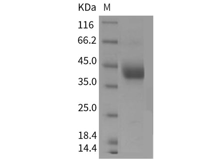 Recombinant Mouse ART4/CD297 Protein (His Tag)