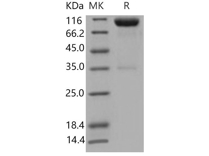 Recombinant Mouse Axl Kinase Protein (His & Fc Tag)