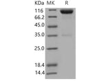 Recombinant Mouse Axl Kinase Protein (His & Fc Tag)