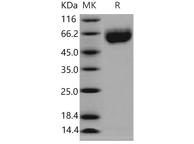 Recombinant Mouse Axl Kinase Protein (His Tag)
