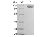 Recombinant Mouse B-cell Receptor CD22/Siglec-2/CD22 (C-6His)