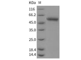 Recombinant Mouse BACE2/Beta secretase 2 Protein (His Tag)(Active)