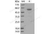 Recombinant Mouse BMPRIA/ALK-3 Protein (His & Fc Tag)(Active)