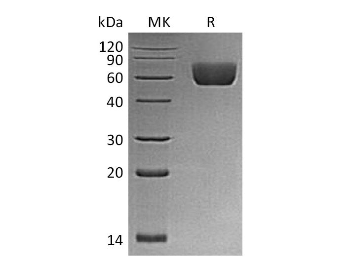 Recombinant Mouse BTNL2/Butyrophilin-like Protein 2 Protein (His Tag)