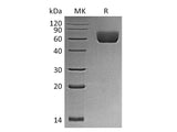 Recombinant Mouse BTNL2/Butyrophilin-like Protein 2 Protein (His Tag)