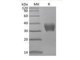 Recombinant Mouse BTNL4 (C-6His)