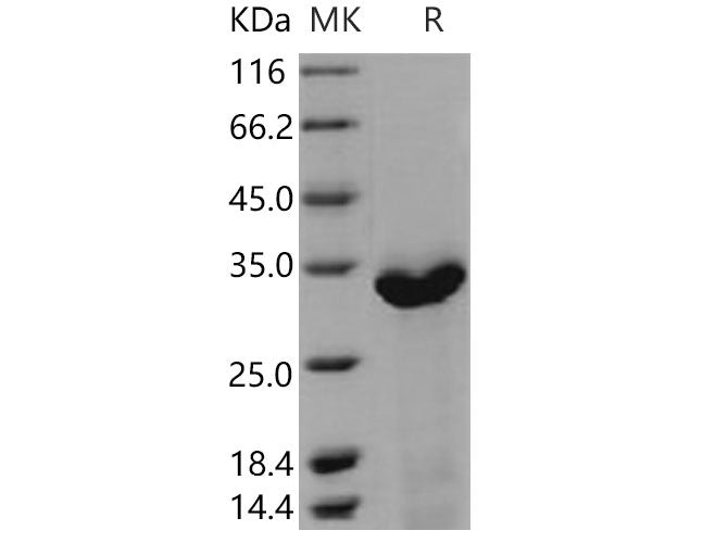 Recombinant Mouse C1QBP Protein (His Tag)