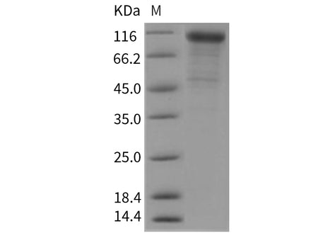 Recombinant Mouse Cadherin-6/CDH6 Protein (His Tag)