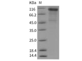 Recombinant Mouse Cadherin-6/CDH6 Protein (His Tag)