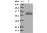 Recombinant Mouse Carbonic Anhydrase XII/CA12 Protein (His Tag)(Active)