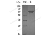 Recombinant Mouse Carboxypeptidase M/CPM Protein (His Tag)(Active)