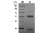 Recombinant Mouse Cathepsin S/CTSS Protein (His Tag)(Active)