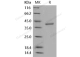 Recombinant Mouse Cathepsin Z Protein (His Tag)(Active)