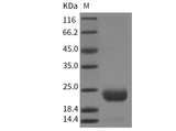 Recombinant Mouse CCDC47 Protein (His Tag)