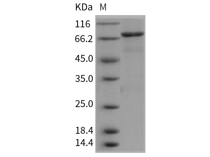 Recombinant Mouse CCNE1/Cyclin-E1 Protein (His & GST Tag)(Active)