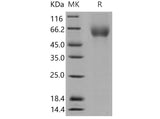 Recombinant Mouse CD155/PVR Protein (aa 1-345, His Tag)(Active)
