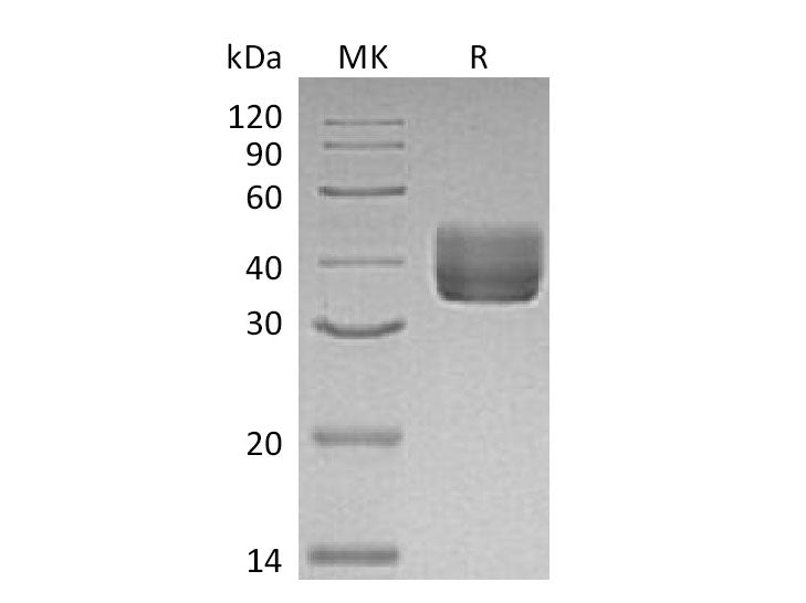 Recombinant Mouse CD157/BST1 Protein (His Tag) Purity >95%
