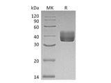 Recombinant Mouse CD157/BST1 Protein (His Tag) Purity >95%