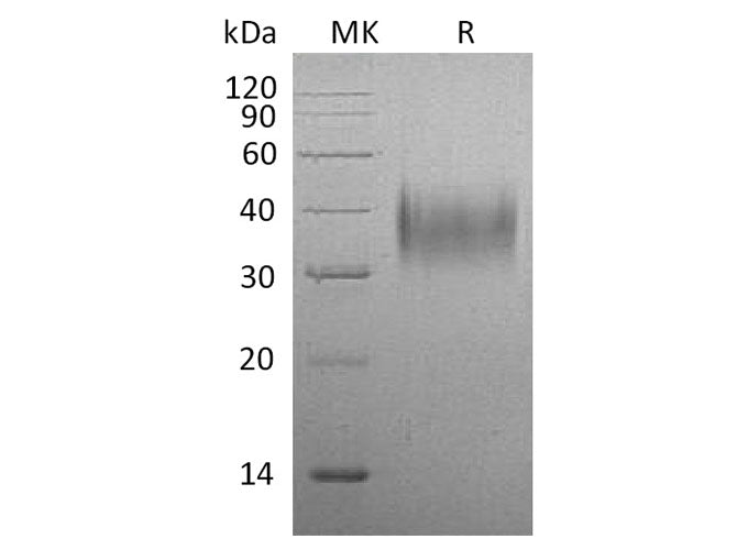 Recombinant Mouse CD16/FCGR3 Protein (His Tag)