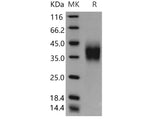 Recombinant Mouse CD16 Protein (His Tag)(Active)