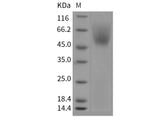Recombinant Mouse CD172a/SIRPA Protein (His Tag)(Active)