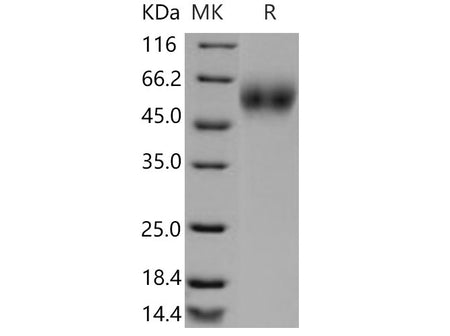 Recombinant Mouse CD200R1 Protein (His Tag)(Active)