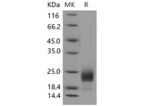 Recombinant Mouse CD302/CLEC13A Protein (His Tag)