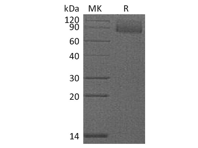 Recombinant Mouse CD36/SCARB3 Protein (AVI & His Tag)